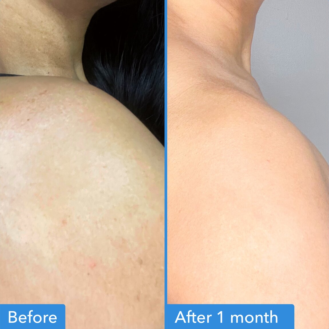 discoloration-correcting-body-treatment-m3 zb_p.jpg