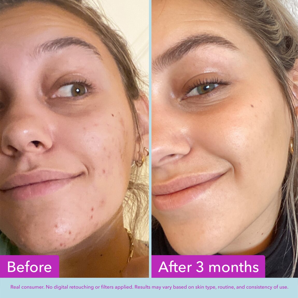 niacinamide-brightening-toner-v2 zb_p.jpg