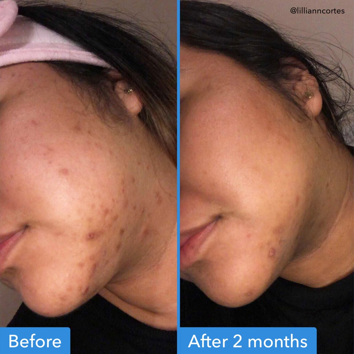 discoloration-correcting-serum-q4 zb_p.jpg